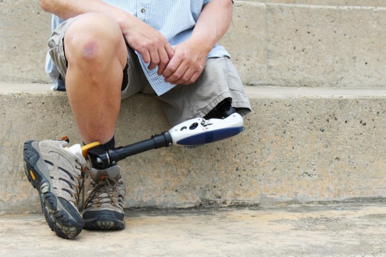 Man with mechanical leg